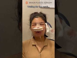 I cried when watching this…😭 #fyp #glowup #facialcontouringsurgery #rhinoplasty #plasticsurgery